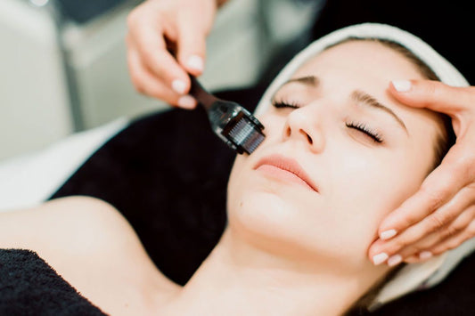 Microneedling: Was kann der Beauty-Trend? | Beauty-Outlet24